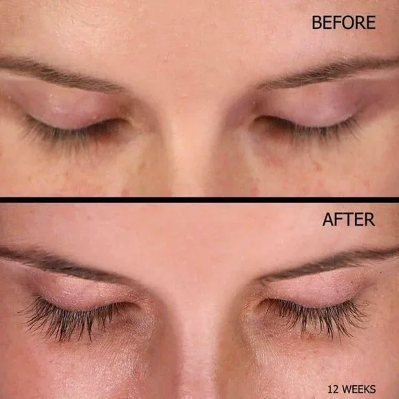 rodan fields eye lash boost serum 5ml - Picture 6 of 9
